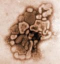 Regio tem 5 vtimas fatais da gripe suna Imagem Ilustrativa. Foto: www.grupoescolar.com