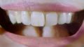  Chineses recriam ''dente'' a partir da urina humana Estudo chins testou o uso de urina para tentar recriar dentes por meio de clulas-tronco. (Foto: BBC)
