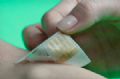 Adesivo inteligente colado na pele aplica remdios na quantidade certa Adesivo intelugente sabe o momento de aplicar remdios no paciente (Foto: Dae-Hyeong Kim / Nature Nanotechnology)