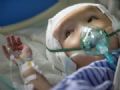  Tecnologia em 3D salva vida de criana com hidrocefalia na China Hanhan, de trs anos, passa bem depois da cirurgia de implante de peas de titnio em seu crnio (Foto: Stringer/Reuters)