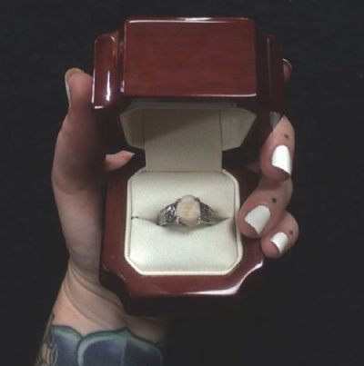  Em vez de diamante, garota recebe anel com dente do siso em noivado Anel de noivado traz dente do siso do noivo (Foto: Reproduo/Facebook/Carlee Alisan Leifkes)