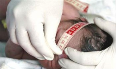  Casos de microcefalia no Brasil sobem de 2.401 para 2.782 em uma semana Foto de divulgao