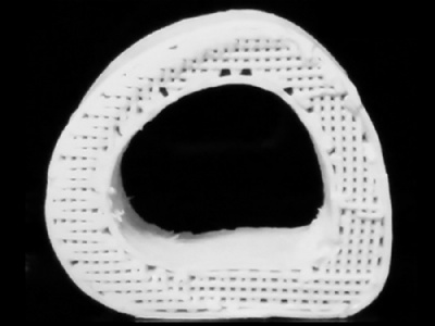 Cientistas consertam fraturas com ossos elsticos impressos em 3D Osso hiperelstico feito com impressora 3D pode ser opo de tratamento no futuro (Foto: Science Translational Medicine/Divulgao)