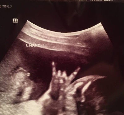  Feto faz sinal de ''mo-chifrada'' em ultrassom e deixa pais orgulhosos Foto: Makelle Ahlin/Facebook