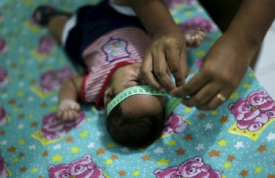 Brasil confirmou 246 casos de microcefalia e outras alteraes ligadas  zika em 2017 Diagnosticado com microcefalia, beb Guilherme Soares Amorim, de 2 meses, tem a cabea medida por sua me, Germana Soares, em sua casa em Ipojuca, em Pernambuco (Foto: Reuters/Ueslei Marcelino) 