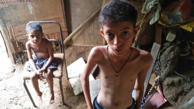 As imagens da tragdia da fome entre crianas na Venezuela Menino venezuelano de 11 anos. Assim como muitas crianas no pas, ele est desnutrido (Foto: Reproduo/BBC) 