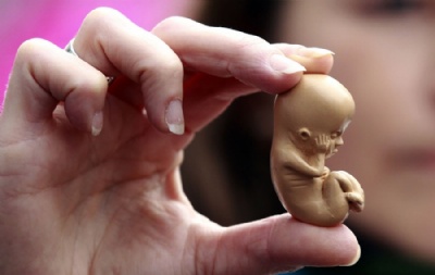 Antes de aborto por estu pro, projeto de lei fala em mostrar imagens de feto a vtimas Uma ativista pr-vida segura modelo de um embrio de 12 semanas de idade, durante um protesto em Belfast, na Irlanda. (Foto: Cathal McNaughton/ Reuters) 