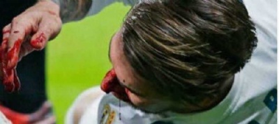 Com nariz fraturado, Srgio Ramos desfalca Real Madrid na Liga dos Campees Foto: Reproduo / Instagram 