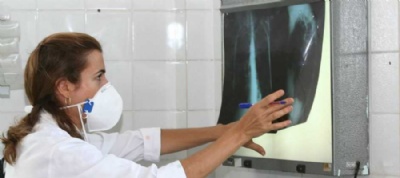 Cidades intensificam busca por pacientes com tuberculose Foto: Dirio Online 